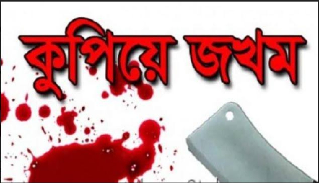 রূপগঞ্জে পূর্বশত্রুতার জেরে যুবককে কুপিয়ে জখম 